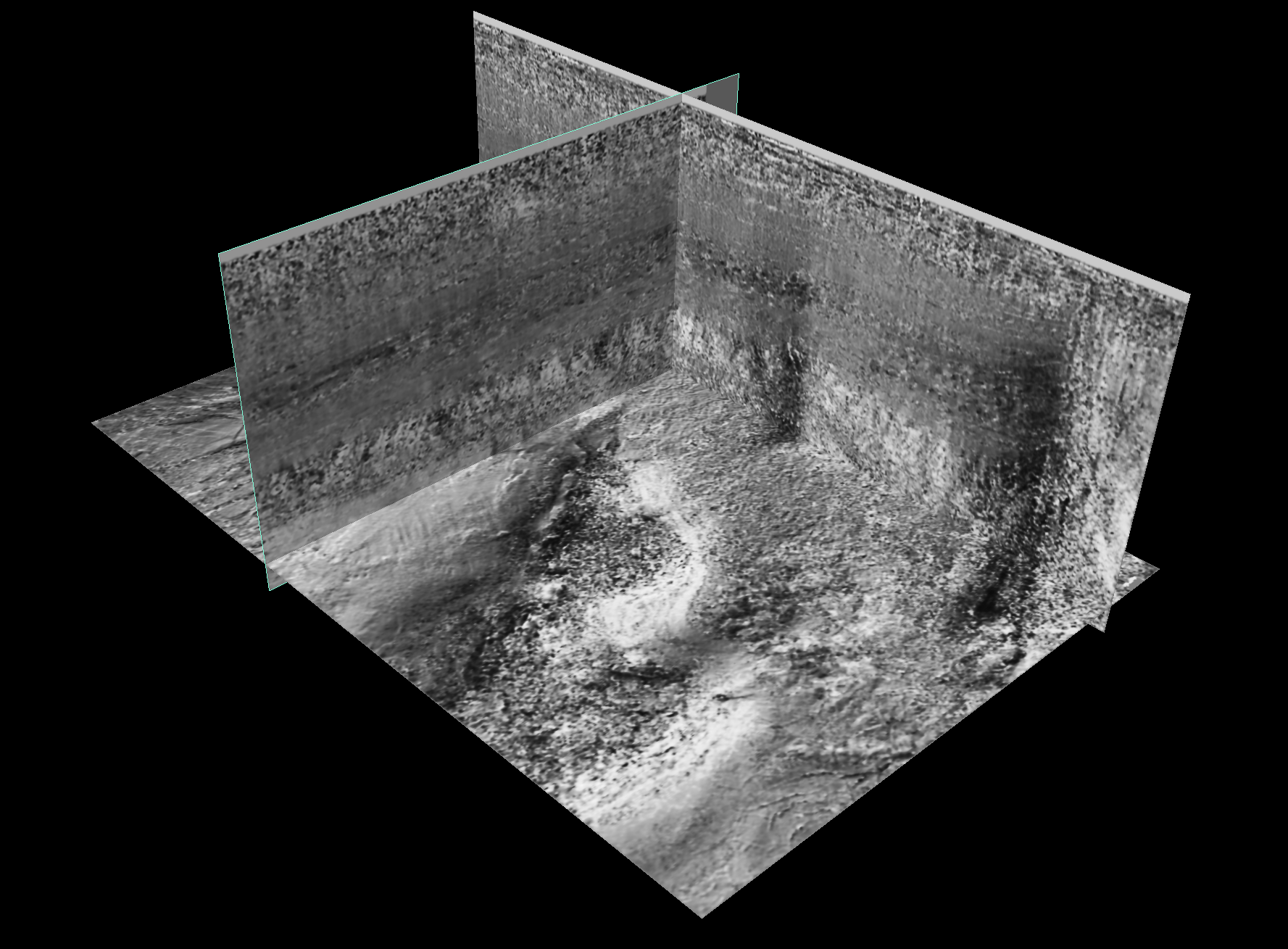 image of dip estimation
